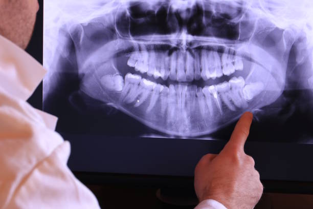 Best Emergency Denture Repair in Stephens City, VA